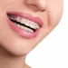 Braces Doctor