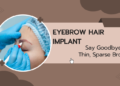 eyebrow hair implant