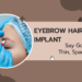 eyebrow hair implant