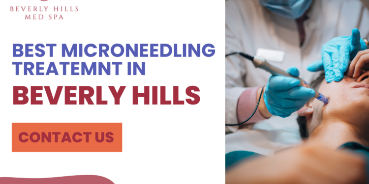microneedling in beverly hills