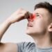 Nasal Polyps Symptoms