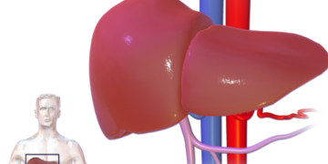 liver treatment in delhi