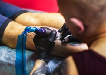 Tattoo Removal