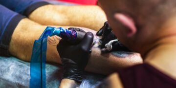 Tattoo Removal