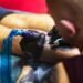Tattoo Removal