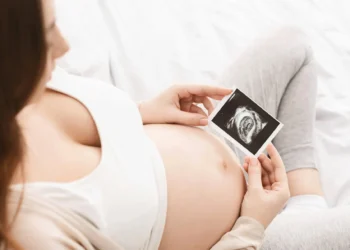 3D/4D Ultrasound