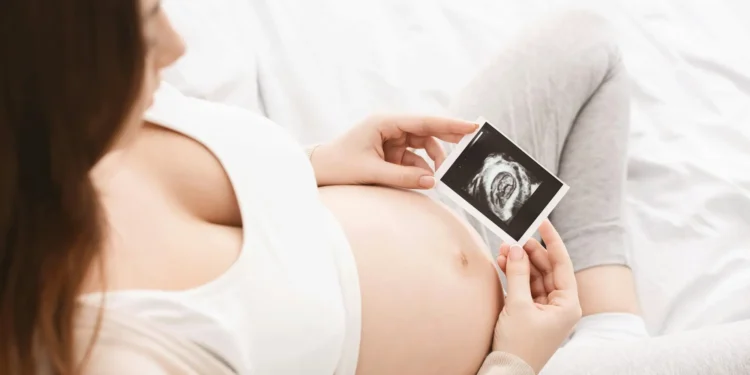3D/4D Ultrasound