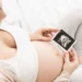 3D/4D Ultrasound