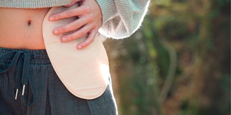 Stoma & Ostomy Care Market