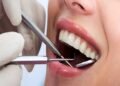 Teeth Cleaning and Polishing in Riyadh