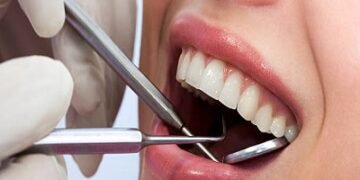 Teeth Cleaning and Polishing in Riyadh