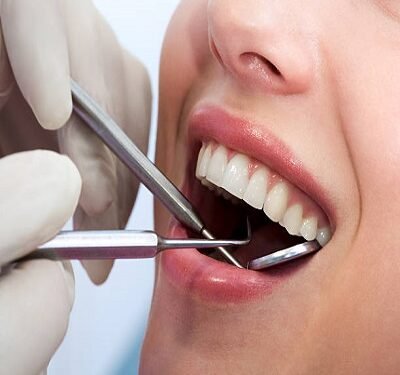 Teeth Cleaning and Polishing in Riyadh