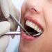 Teeth Cleaning and Polishing in Riyadh