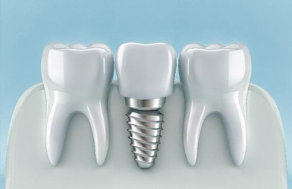 Dental